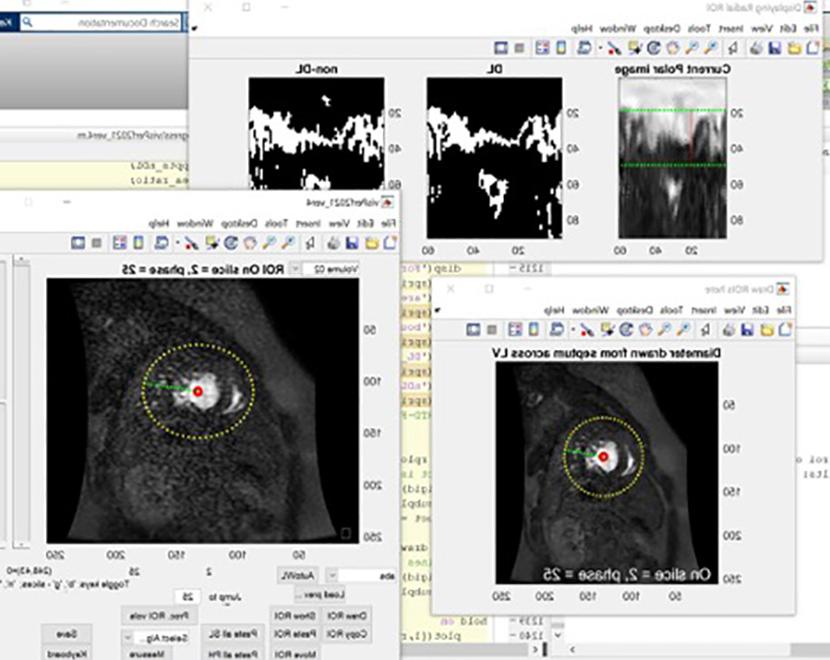 医师操作员指导工具的生物医学图像处理使用Matlab 2021